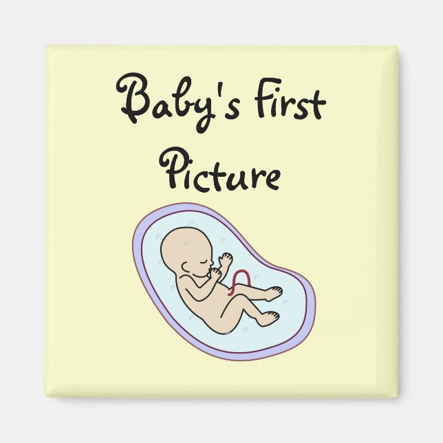 Imã Magnet "Sonograma" (Frente)