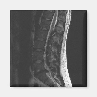 Imã Magneta de Disco Ruptura