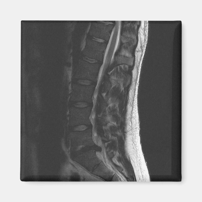 Imã Magneta de Disco Ruptura (Frente)