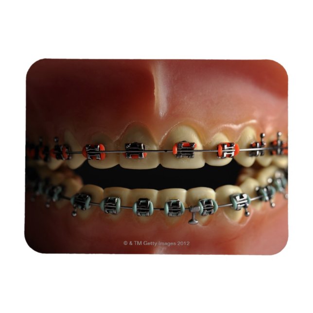 Ímã Modelo dental e aparelho dentário (Horizontal)