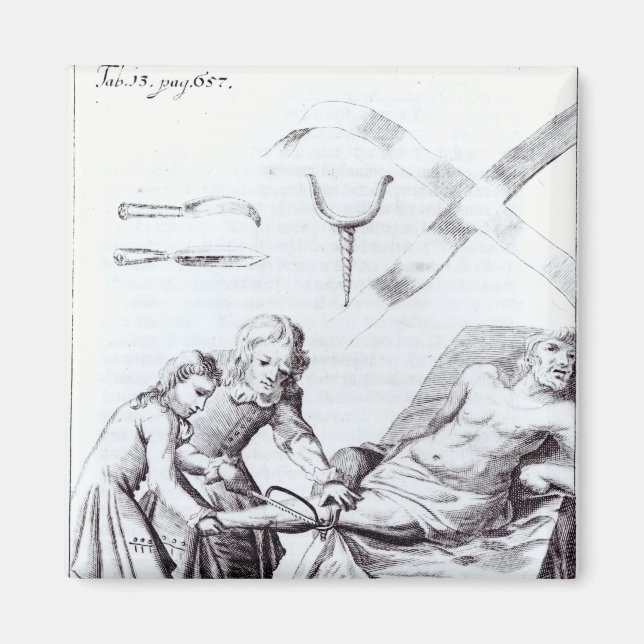 Imã Operação cirúrgica para amputar uma perna (Frente)