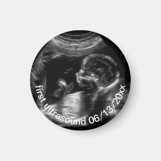 Imã Para Nova Mãe Primeiro Sonograma Ultrassônico