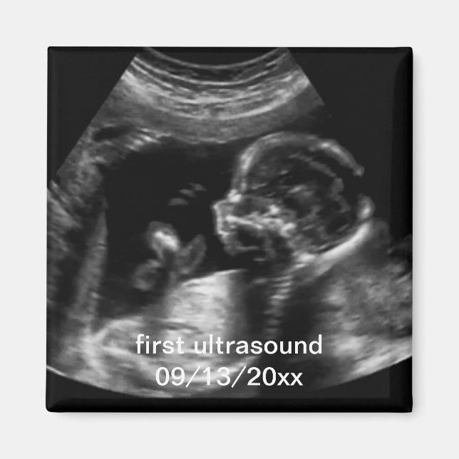 Imã Para Nova Mãe Primeiro Sonograma Ultrassônico (Frente)