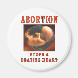 IMÃ PARADAS DO ABORTO