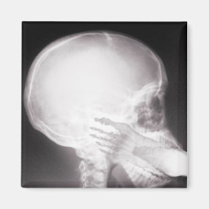 Imã Pé em raios X da Boca