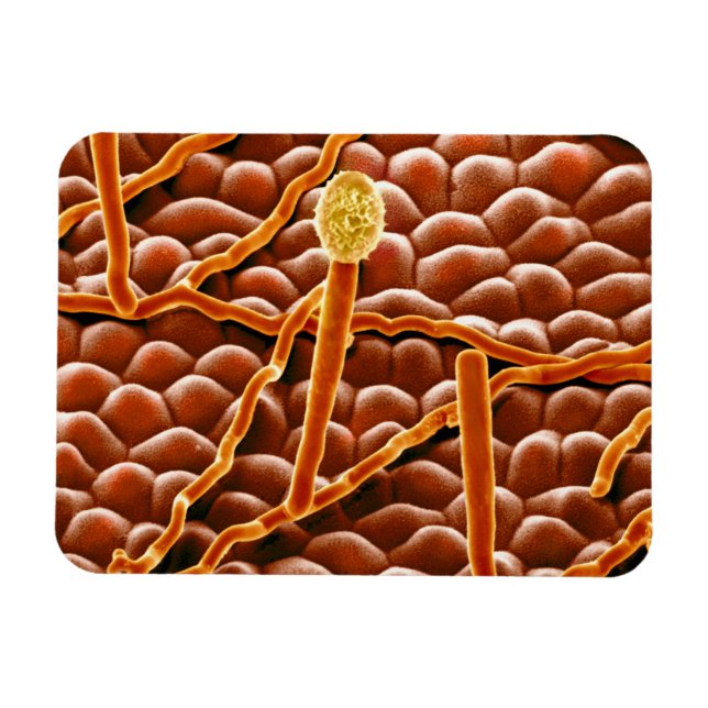 Ímã Powdery Mildew Fungus em Poinsettia (Horizontal)