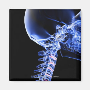 Imã Radiografe a imagem dos ossos do pescoço