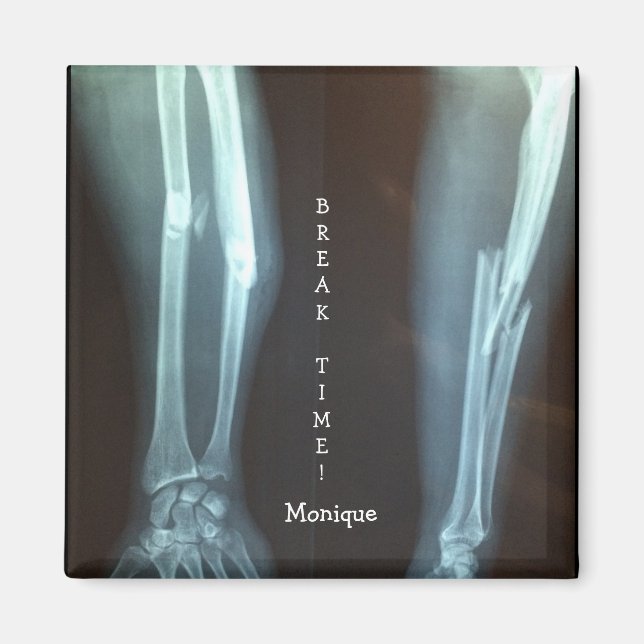 Imã Radius quebrado e Ulna Xray "Break Time" (Frente)