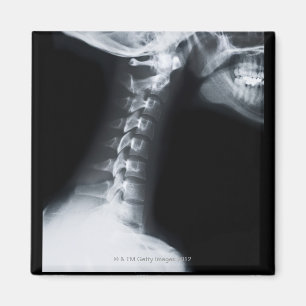 Imã raio X das vértebras do pescoço, incluindo a mandí