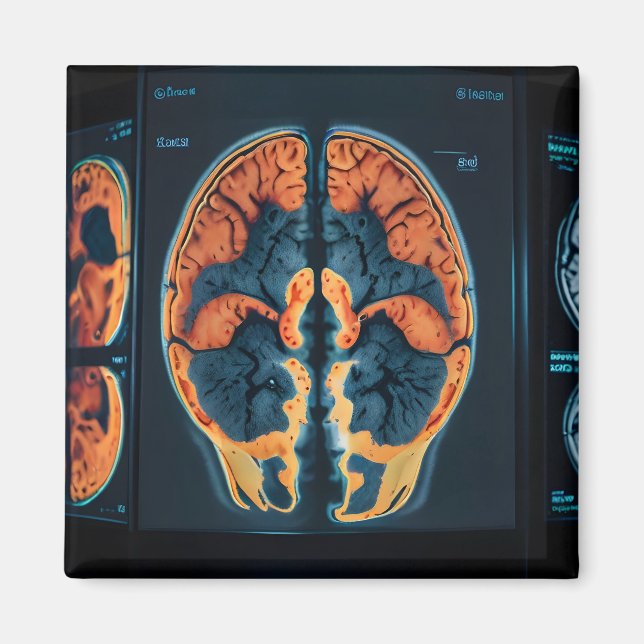 Imã ressonância magnética cerebral (Frente)