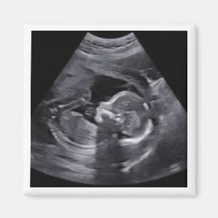Imã Sonograma Grávida Eterno de Fotografia Keepsasasaa
