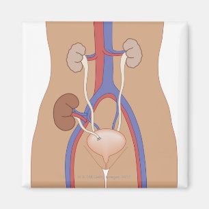 Imã Transplante renal