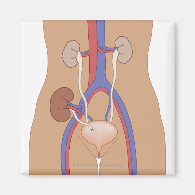 Imã Transplante renal (Frente)