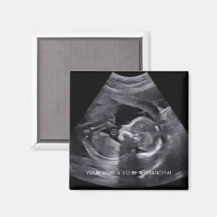 Imã Vai ser uma FOTO de Sonograma Grávida de GRANDMA