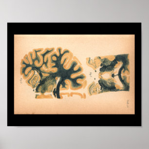 Impressão 1901 da anatomia do cérebro do vintage