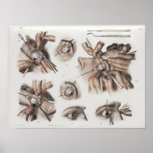 Impressão da anatomia do vintage da optometria da