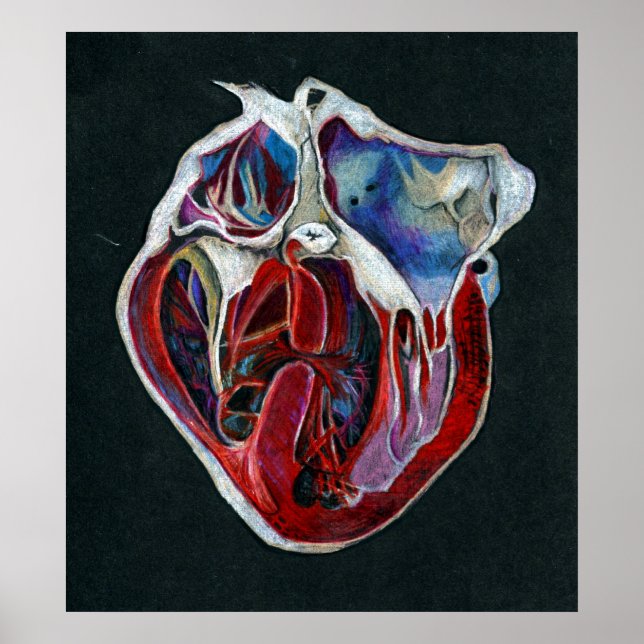 impressão de shunt (Frente)