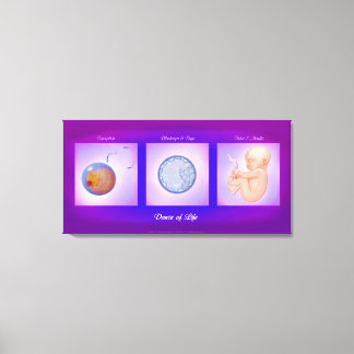 Impressão De Telas De Arte De Gravidez Da Dança De