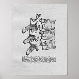 Impressão do vintage do Subluxation da