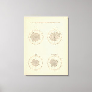 Impressão Em Tela 113 mortes em o mês 1900