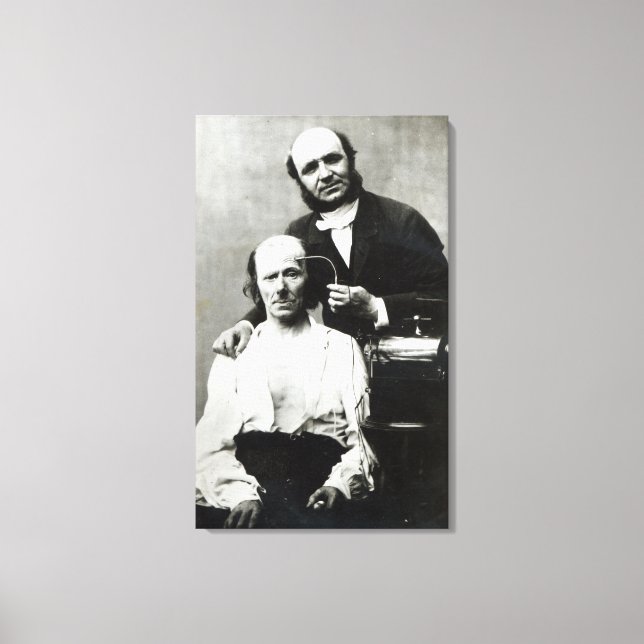 Impressão Em Tela Duchenne de Boulogne com um "paciente vítima" (Frente)