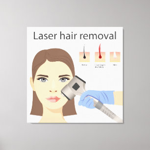 Impressão Em Tela Estrutura de remoção de cabelo laser