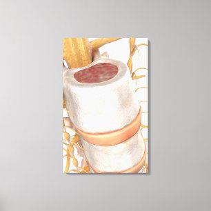 Impressão Em Tela Feche acima de um disco invertebral na espinha