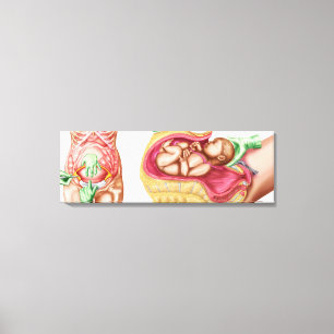 Impressão Em Tela Ilustração que mostra a entrega Caesarean do fet