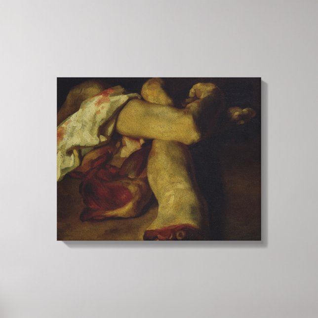 Impressão Em Tela Peças Anatômicas (Frente)