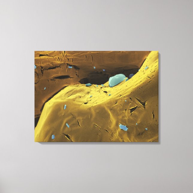 Impressão Em Tela Pó de ureia (Frente)