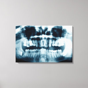 Impressão Em Tela Raio-X de dentes