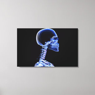 Impressão Em Tela Raio X dos ossos no pescoço