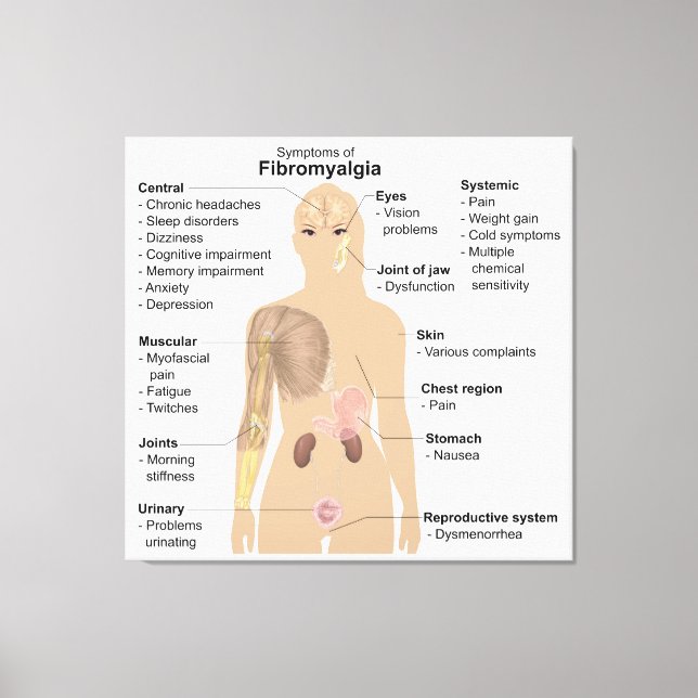 Impressão Em Tela Sinais de Gráfico Sintomas Fibromialgia Tela de im (Frente)