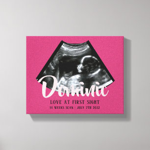 Impressão Em Tela Sonograma KeepsasaBaby Ultrasom