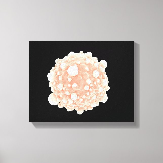 Impressão Em Tela Visão Microscópica Da Célula Do Câncer de pâncreas (Frente)