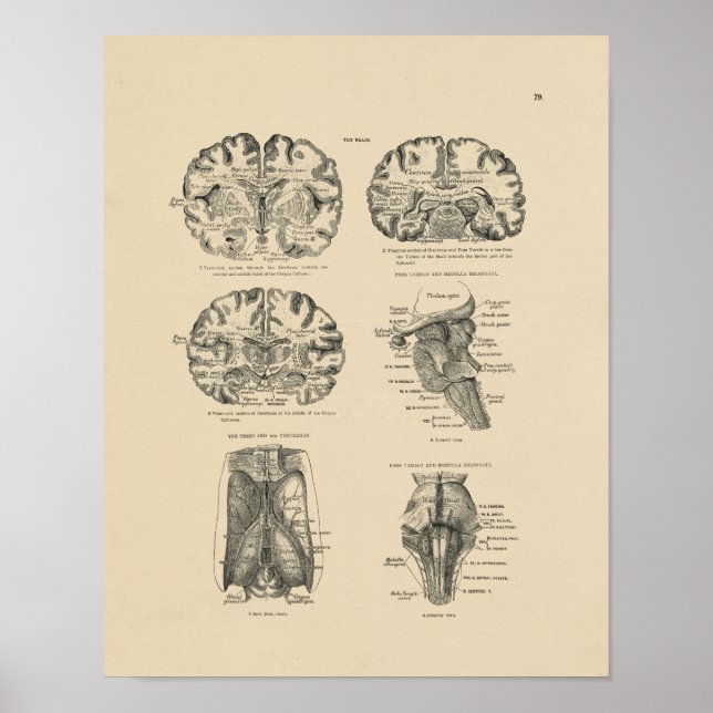 Impressão Vintage Human Brain Anatomy 1880 (Frente)
