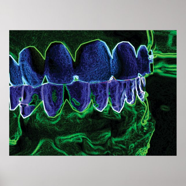 Legal Teeth Model Dentist Orthodontist Poster (Frente)