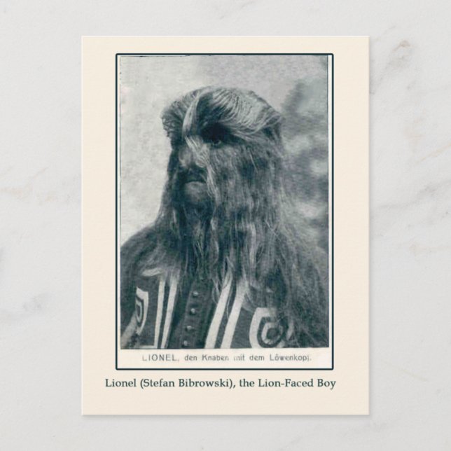 Lionel, os Cartões de Menino e Cartões-postais de  (Frente)
