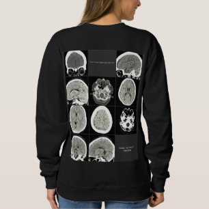 Moletom Esta é a depressão parecida com_FULLCTScan