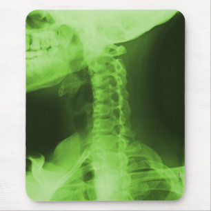 Mousepad 2 radiografados - Verde radioativo