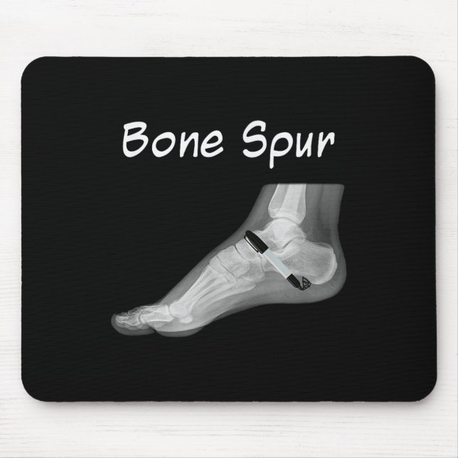 Mousepad Caneta de Tinta com Esforço Óssea Engraçado Anti-T (Frente)