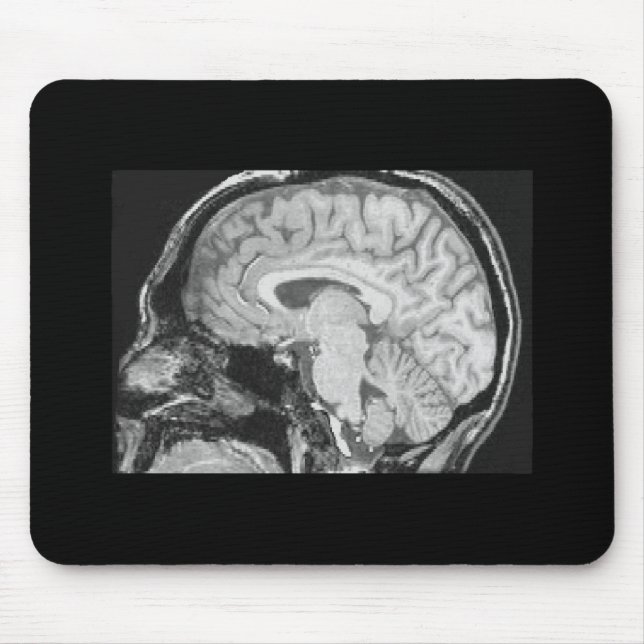Mousepad Cérebro MRI (Frente)