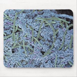 Mousepad Chapa dental, elétron de varredura colorido