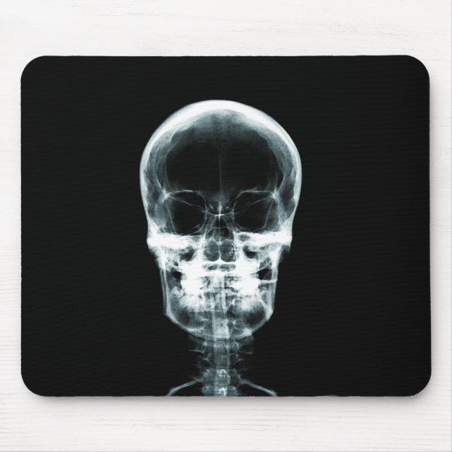 MOUSEPAD CRÂNIO DE ESQUELETO DA VISÃO DO RAIO X - ORIGINAL (Frente)