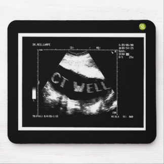 Mousepad CT Ondulas Mousepade (CT Ondulas na barriga)