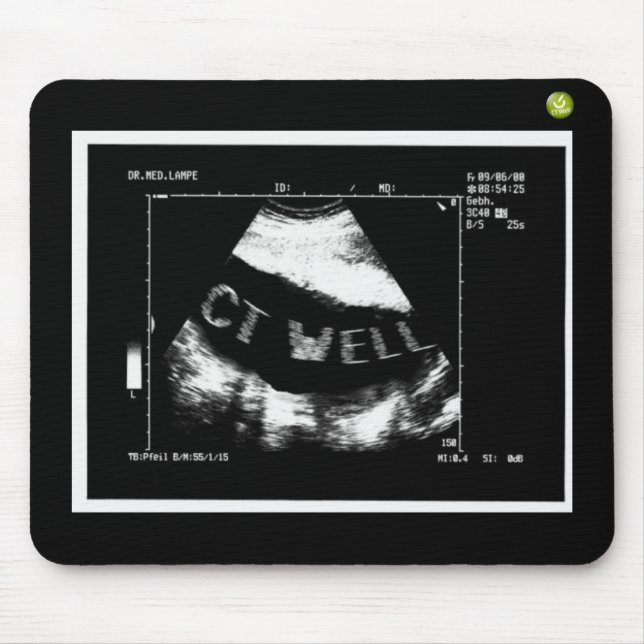 Mousepad CT Ondulas Mousepade (CT Ondulas na barriga) (Frente)