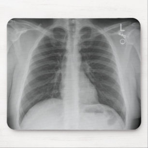 Mousepad de raios X
