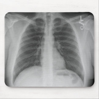 Mousepad de raios X