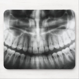 Mousepad Dentes de Raio X Sorriem Preto e Branco