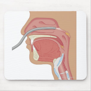 Mousepad Endoscopia do Nariz